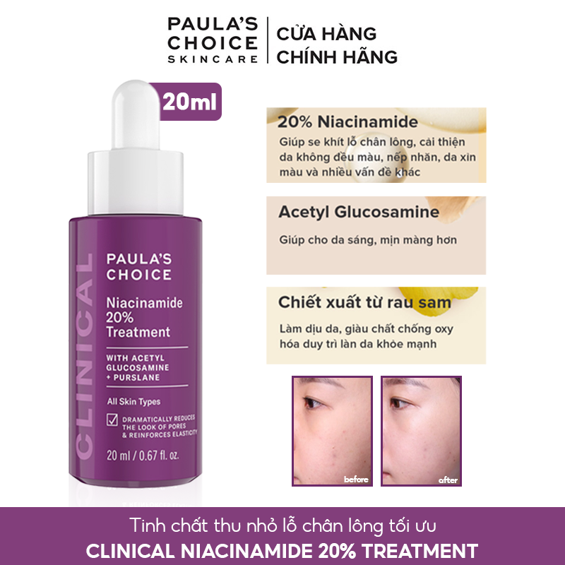 Tinh Chất Dưỡng Da, Thu Nhỏ Lỗ Chân Lông Paula's Choice Niacinamide 20% Treatment 20ml