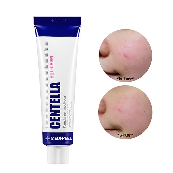 Kem Dưỡng Cải Thiện Da Mụn Medi-Peel Centella Mezzo Cream 30ml