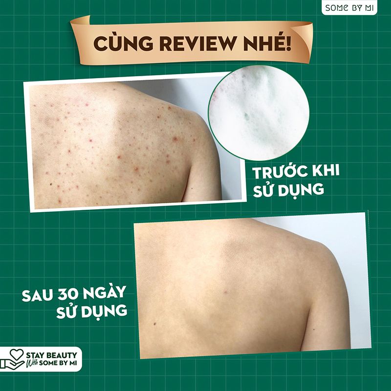 Sữa Tắm Làm Sạch Mụn Cơ Thể Some By Mi AHA-BHA-PHA 30 Days Miracle Acne Clear Body Cleanser 400g