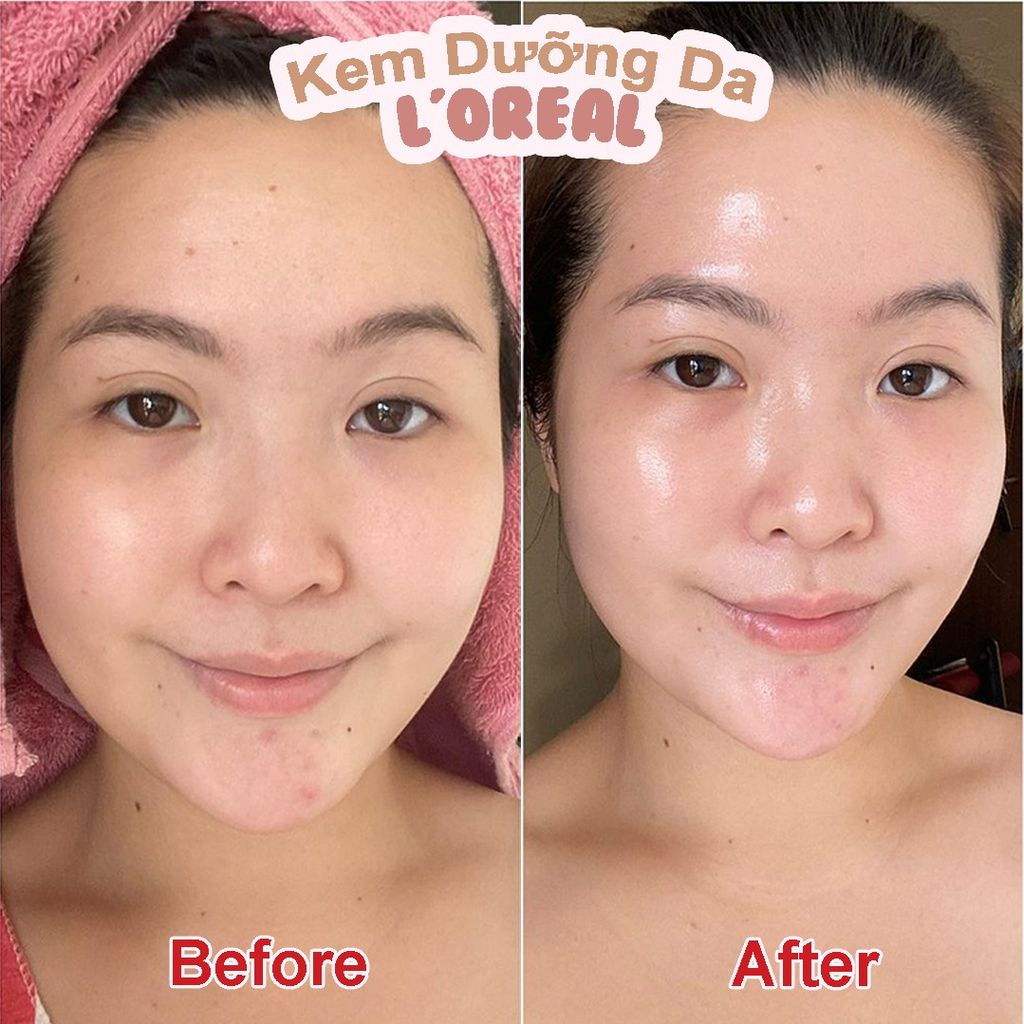 Kem Dưỡng Da Hỗ Trợ Mờ Thâm Nám Ban Đêm L'Oreal Glycolic Bright Glowing Cream Night