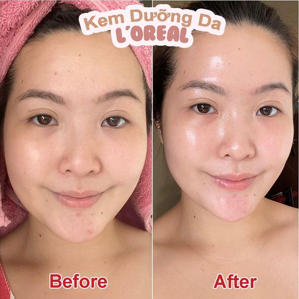 Kem Dưỡng Da L'Oreal Hỗ Trợ Mờ Thâm Nám Ban Đêm Glycolic Bright Glowing Cream Night 50ml