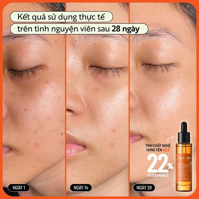 Serum Cocoon Tinh Chất Hỗ Trợ Làm Sáng, Mờ Thâm Chiết Xuất Nghệ Hưng Yên Cocoon Hung Yen Turmeric Serum c22 Vitamin C 30ml