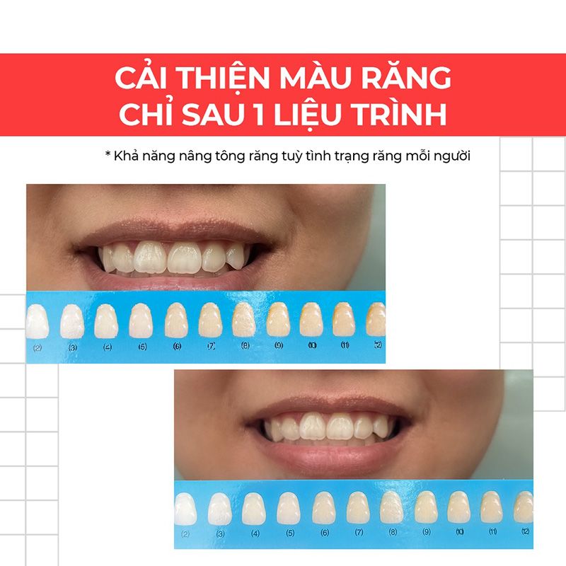 Miếng Dán Trắng Răng An Toàn Ít Ê Buốt Halio Teeth Whitening