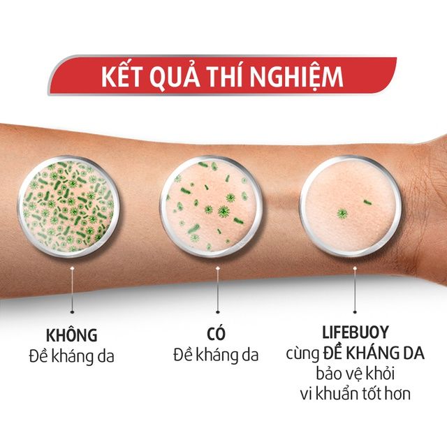 Sữa Tắm Bảo Vệ Da Vi Khuẩn Lifebuoy Chăm Sóc Da