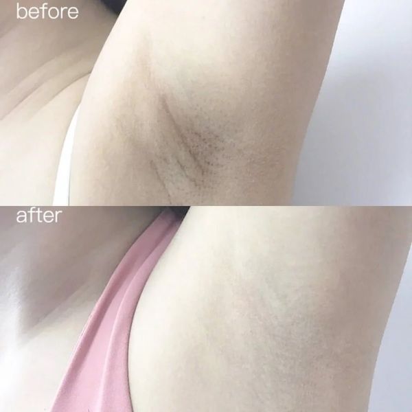Lăn Khử Mùi Angel's Liquid Mờ Thâm, Dưỡng Trắng Da Glutathione+ Niacinamide Arbutin Cooling Fresh Deodorant 60ml (Che tên sản phẩm khi giao hàng)