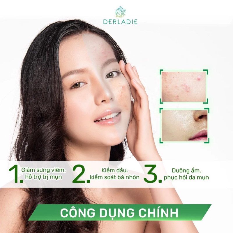 Kem Dưỡng Cải Thiện Mụn Kiềm Dầu 12H Derladie Herbal Extract Care Cream 50ml