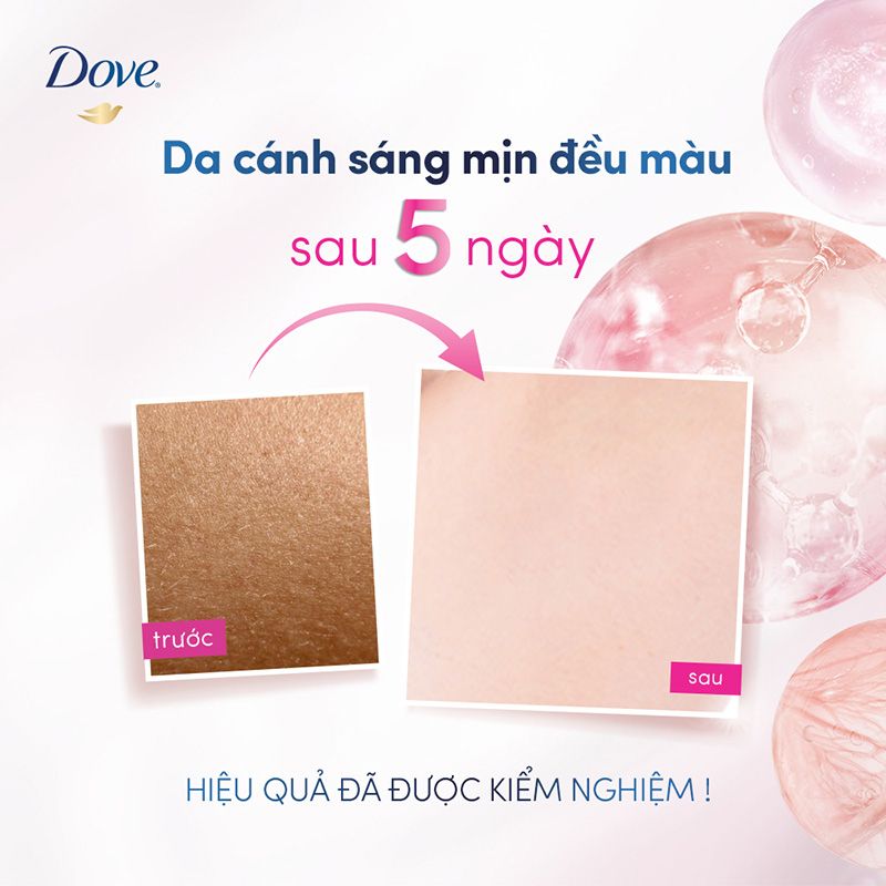 Lăn Khử Mùi Tinh Chất Serum Sáng Da, Mờ Thâm DOVE NIA 45ml