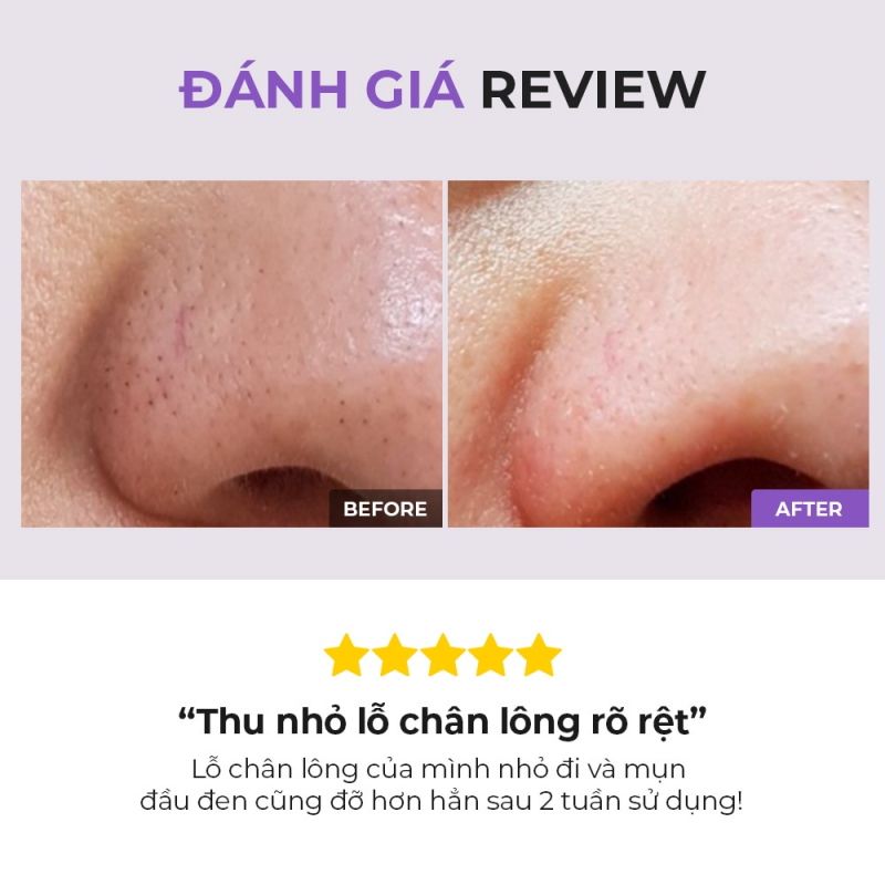 Tẩy Tế Bào Chết Hóa Học Hỗ Trợ Giảm Đầu Đen, Mụn Ẩn, Lỗ Chân Lông To Cosrx BHA Blackhead Power Liquid 50ml