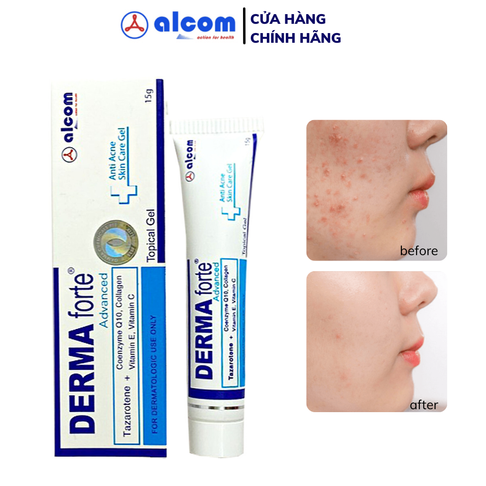 Gel Hỗ Trợ Giảm Mụn, Giảm Thâm Derma Forte Topical Gel 15g