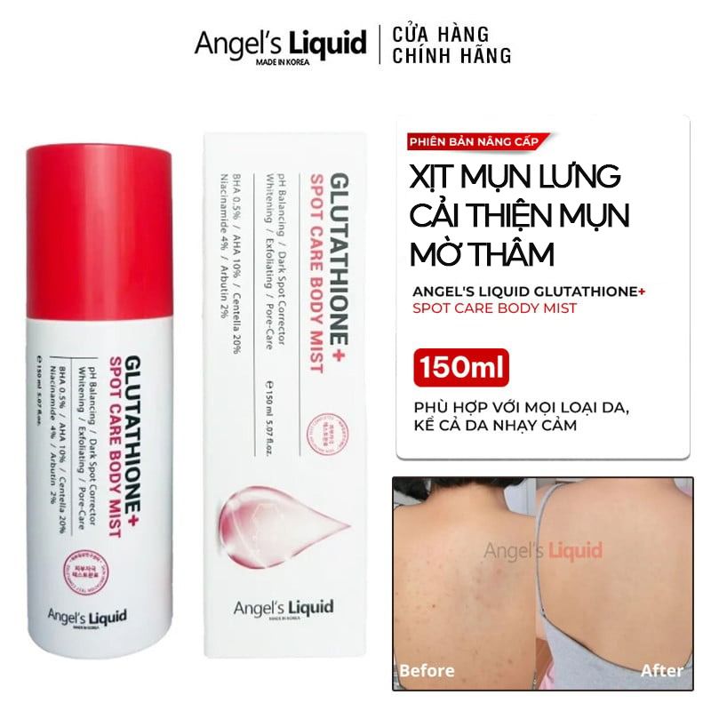 Xịt Hỗ Trợ Cải Thiện Mụn Lưng, Mờ Thâm Sau Mụn Mụn Angel's Liquid Glutathione+ Spot Care 150ml