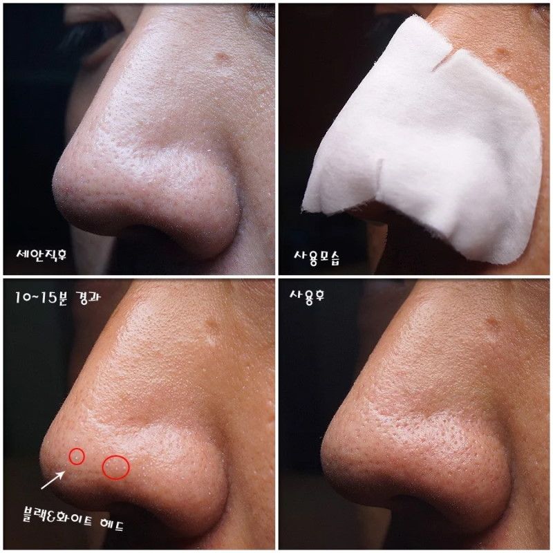 Miếng Dán Hút Mụn Đầu Đen, Sợi Bã Nhờn Ciracle Blackhead Cotton Mask 5ml