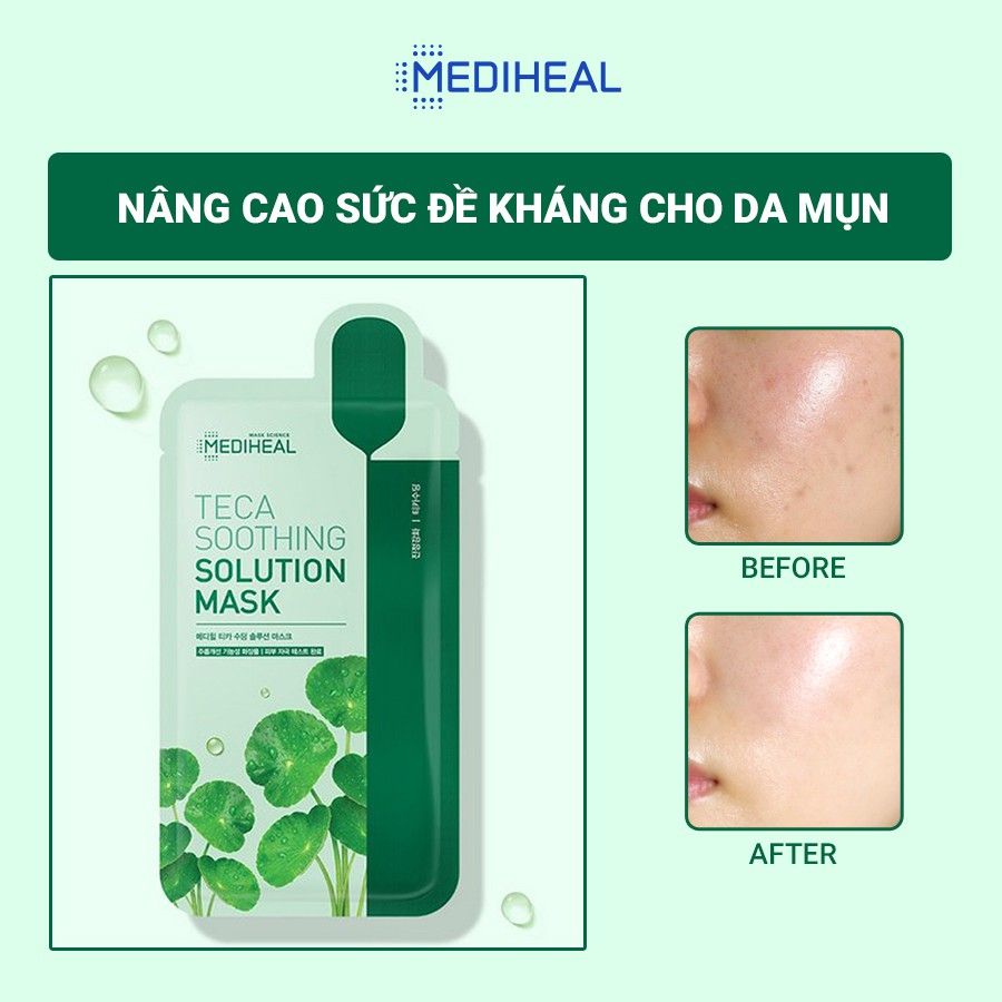 Mặt Nạ Dưỡng Ẩm, Phục Hồi Chuyên Sâu Mediheal Solution Mask