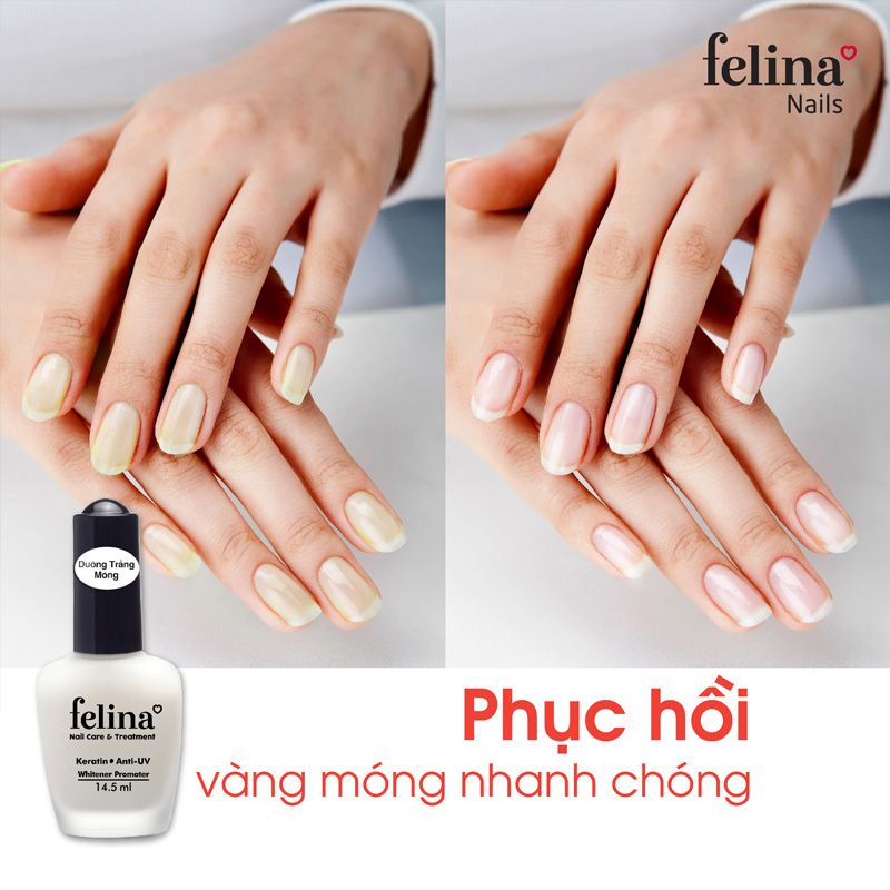 Sơn Dưỡng Móng, Tái Tạo Lớp Nền Felina Nail Care & Treatment 14.5ml