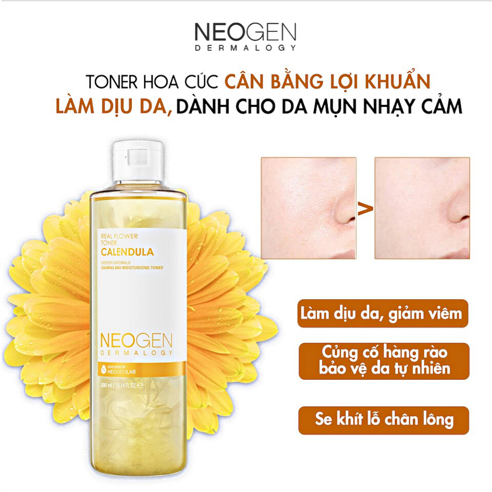 Nước Hoa Hồng Chiết Xuất Hoa Cúc Siêu Cấp Ẩm Dịu Da Cho Da Mụn Neogen Dermalogy Real Flower Calendula Toner 300ml