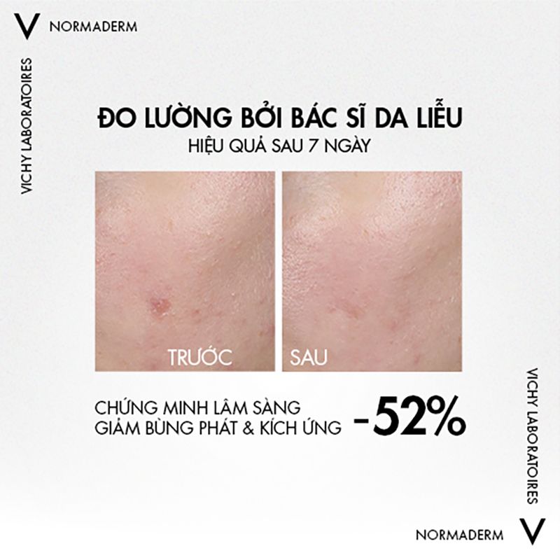 Serum Vichy Tinh Chất Dưỡng Làm Dịu Da, Cải Thiện Da, Giảm Mụn Vichy Normaderm Probio-BHA Anti Imperfections Serum 30ml