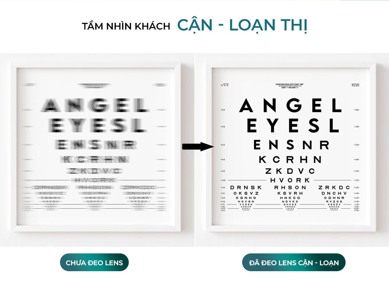 THE HIGH-QUALITY CLEAR ASTIGMATISM CONTACT LENSES