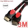 Cáp HDMI 1.5M đến 50M full HD1080P cáp tròn bọc lưới