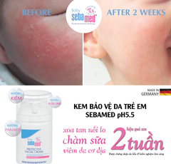 Kem bảo vệ da, trị chàm sữa cho bé Sebamed  Protective Facial Cream pH5.5 50ml