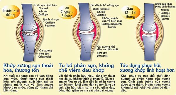 Viên uống bổ khớp của Mỹ Kirkland Signature™ Glucosamin HCL & MSM 1500mg hộp 375 viên