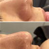 Ủ MỤN ĐẦU ĐEN REMOVE BLACKHEADS