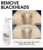 Ủ MỤN ĐẦU ĐEN REMOVE BLACKHEADS