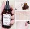 Serum nhau thai Fracora White’st Placenta Extract 30ml