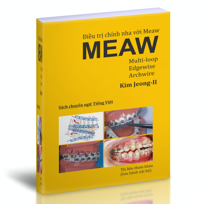 Sách Điều trị chỉnh nha với MEAW (Dây cung thẳng đa loop) của tác giả Kim Jeong II