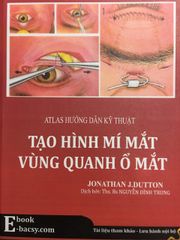 Tạo hình Mí Mắt vùng quanh ổ Mắt