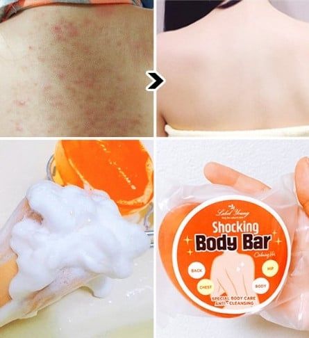 005. Bánh xà phòng trị mụn lưng Label Young Shocking Body Bar