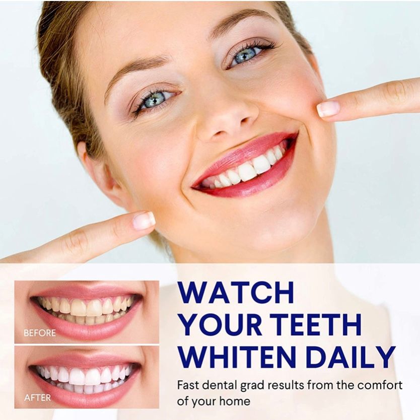 Máy làm trắng răng VieBeauti Teeth Whitening Kit - 5X LED