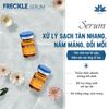 Serum Xử Lý Tàn Nhang/ Nám Mảng/ Đồi Mồi Shafana- Freckle Serum