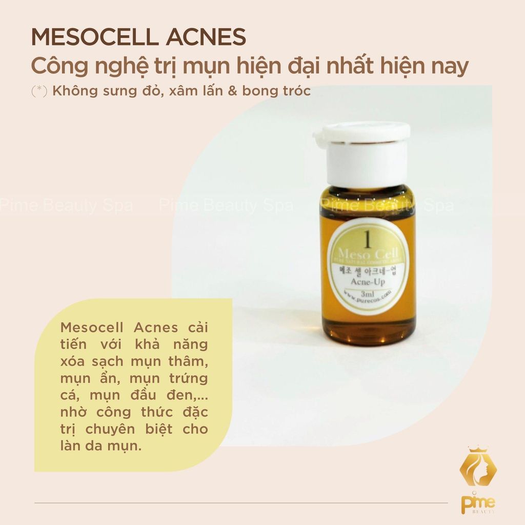  MESOCELL FOR ACNE 