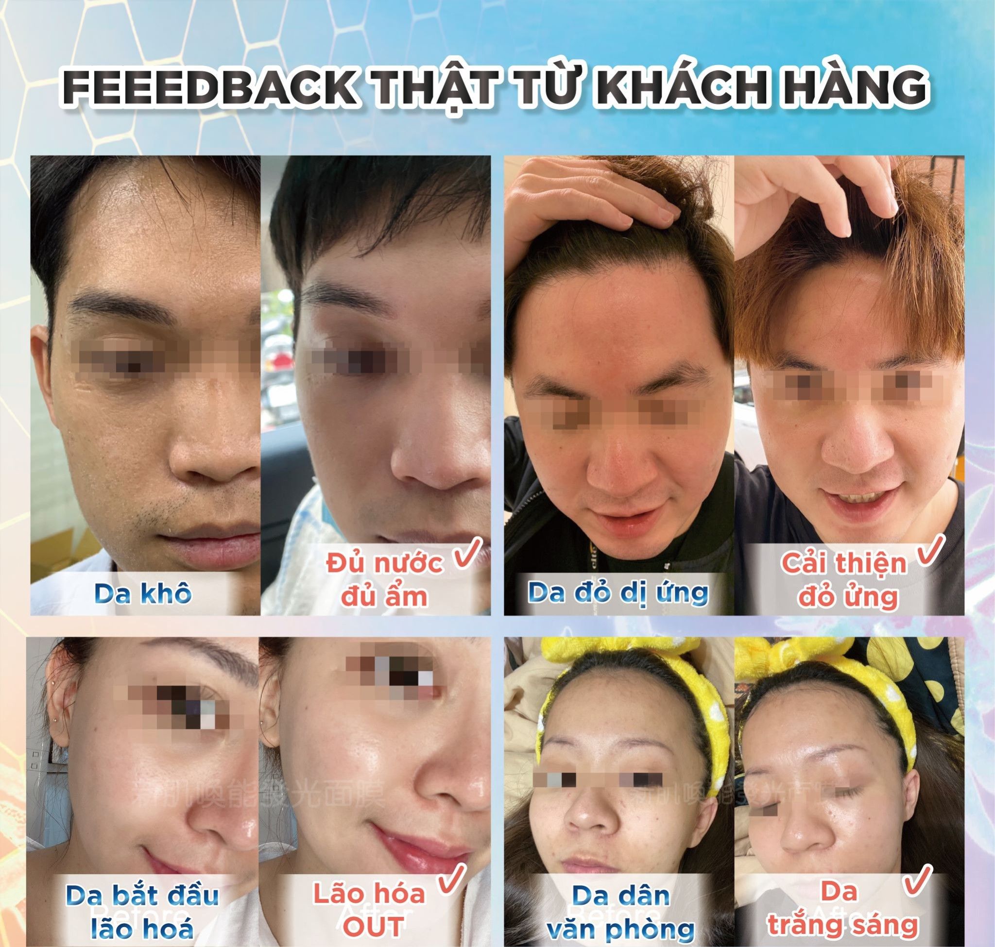 Mặt nạ phát sáng kháng khuẩn phục hồi da Beauty Player Light Mask (Hộp 5 miếng)