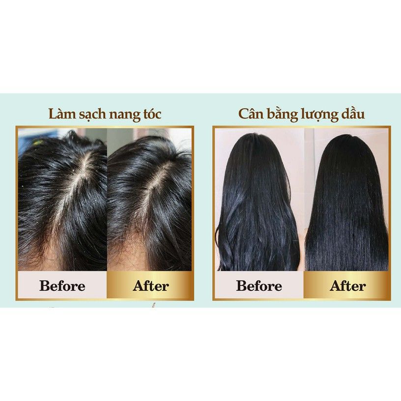 Combo dầu gội PARCO Dưỡng Tóc Chuẩn Salon - Kiềm dầu hiệu quả (Dầu gội xanh + Tinh chất + Dầu xả)
