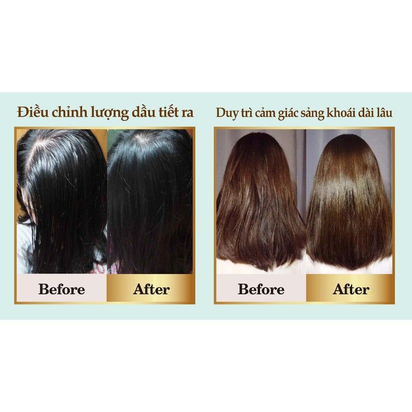 Combo dầu gội PARCO Dưỡng Tóc Chuẩn Salon - Kiềm dầu hiệu quả (Dầu gội xanh + Tinh chất + Dầu xả)