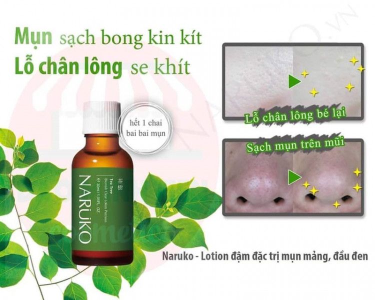TINH CHẤT CHẤM MỤN TRÀM TRÀ NARUKO 30mL