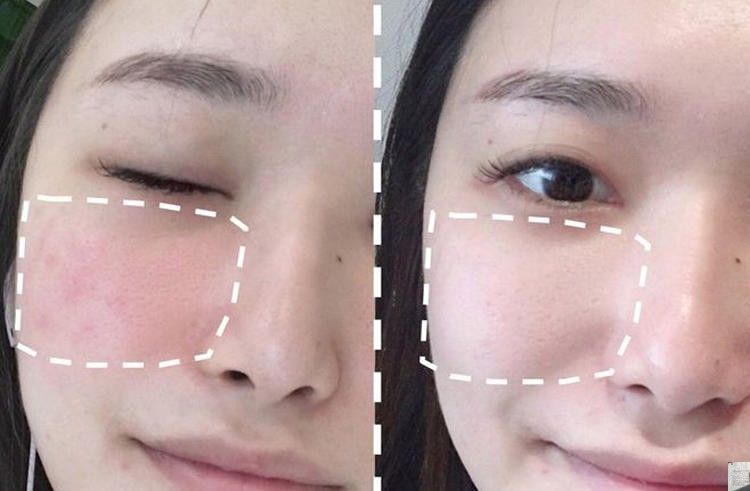 Máy massage mắt chống lão hoá Eye Beauty Fairy Stick