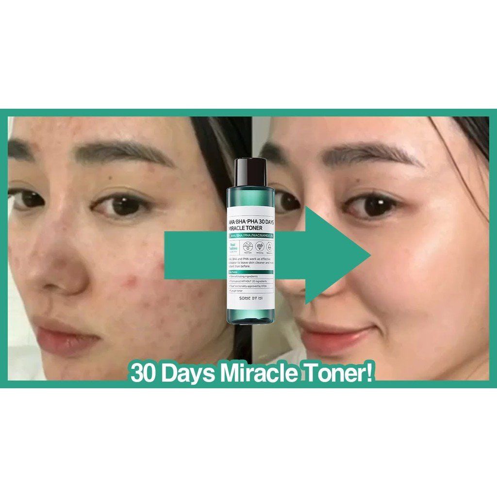 Nước hoa hồng Some By Mi Miracle Toner AHA BHA PHA 30 ngày dưỡng ẩm loại bỏ mụn 150ml