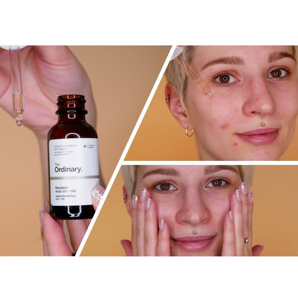 Serum the Ordinary Mandelic Acid 10% + HA tẩy tế bào chết siêu dịu nhẹ, cải thiện thâm mụn cho da trắng mịn