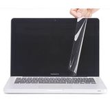 Dán bảo vệ JcPal MacGuard 3 in 1 Set Macbook Pro Retina 13