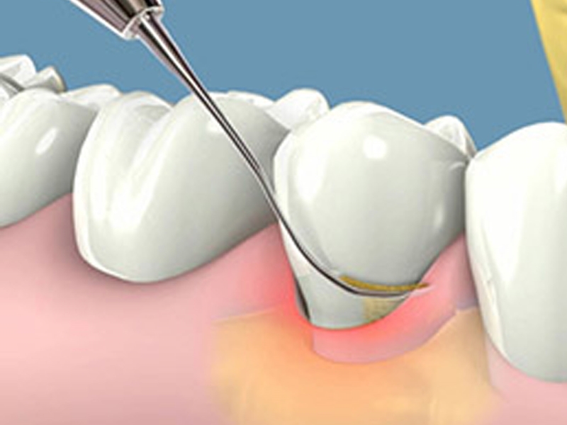 Nha-chu-benh-nguyen-in-dental-3