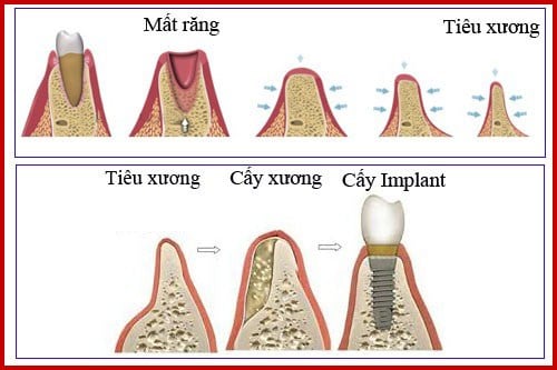 http://nhakhoanhantam.com/p><p style=