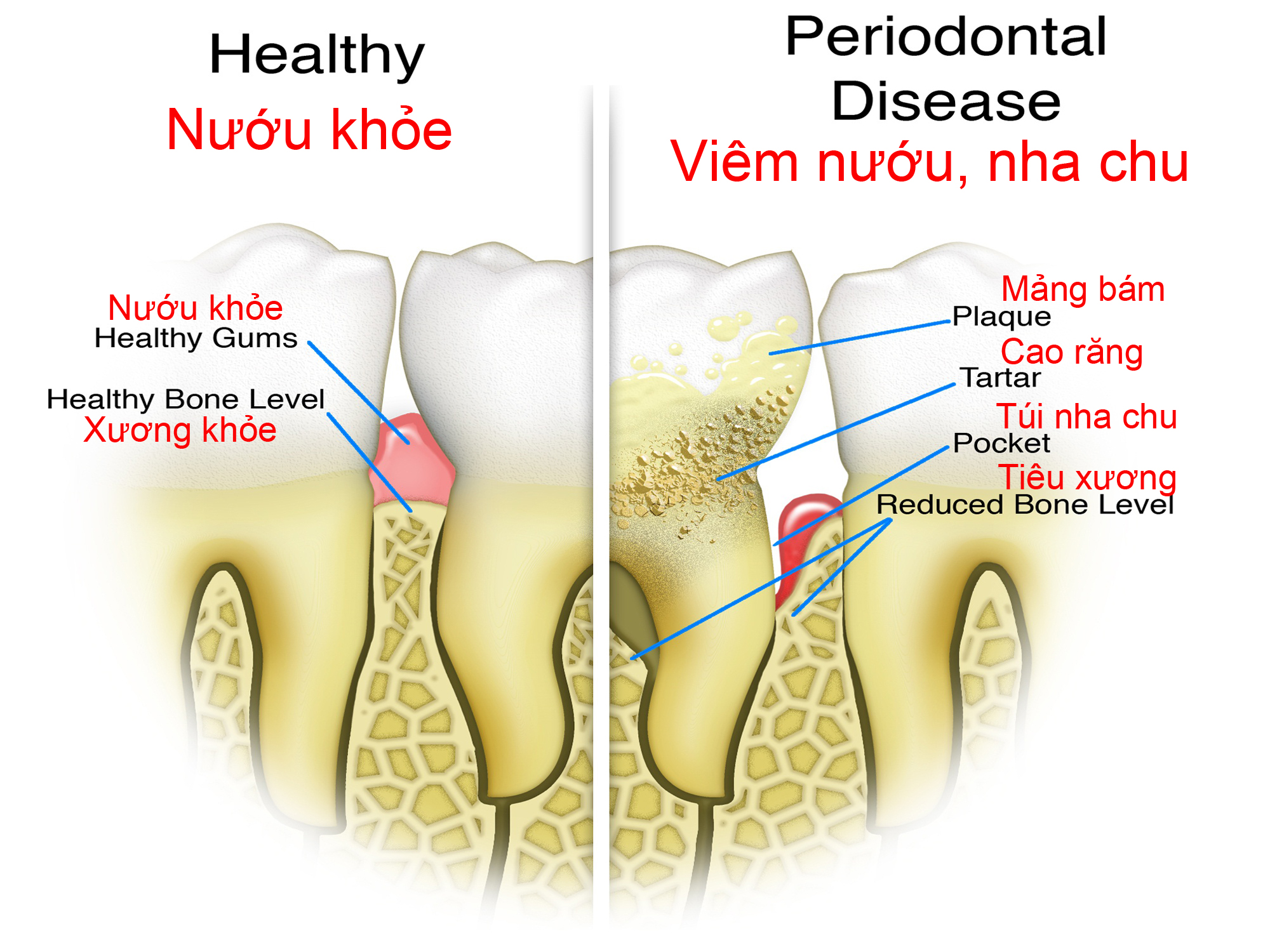tong-quat-ve-nha-chu
