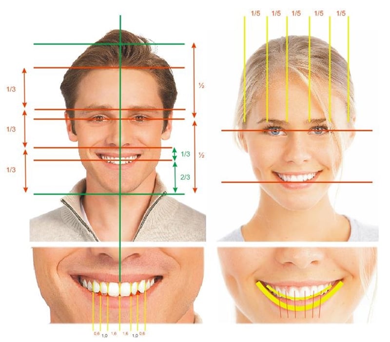 Thiet-ke-nu-cuoi-dep-voi-rang-su-va-su-veneer