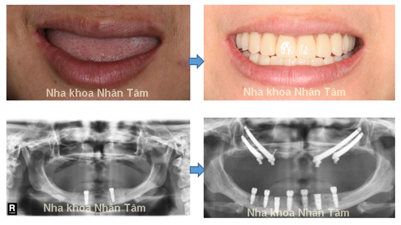 “Bàn tay vàng” ngành nha khoa Việt chia sẻ về giải pháp phát triển du lịch nha khoa