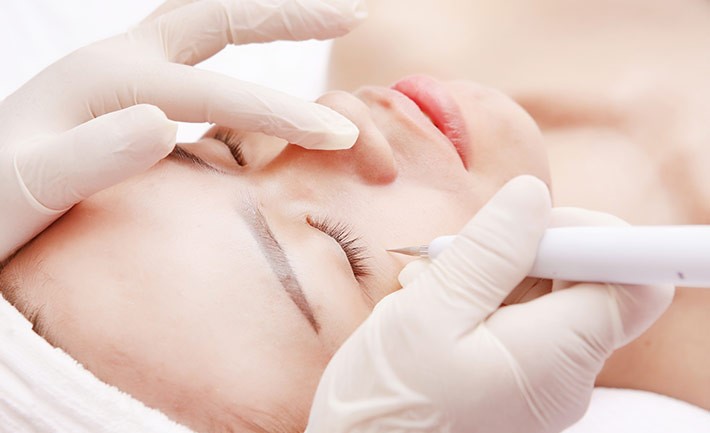 BẮN NỐT RUỒI, TÀN NHANG, MỤN THỊT