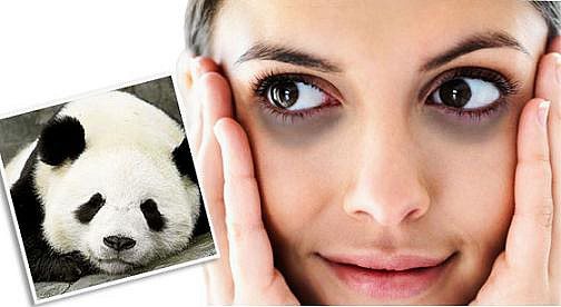 CHĂM SÓC ĐẶC TRỊ XÓA NHĂN, THÂM QUẦNG VÙNG MẮT