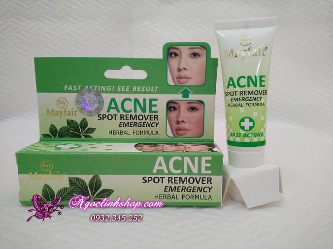 Kem Trị Mụn Mayfair Acne Spot Remover