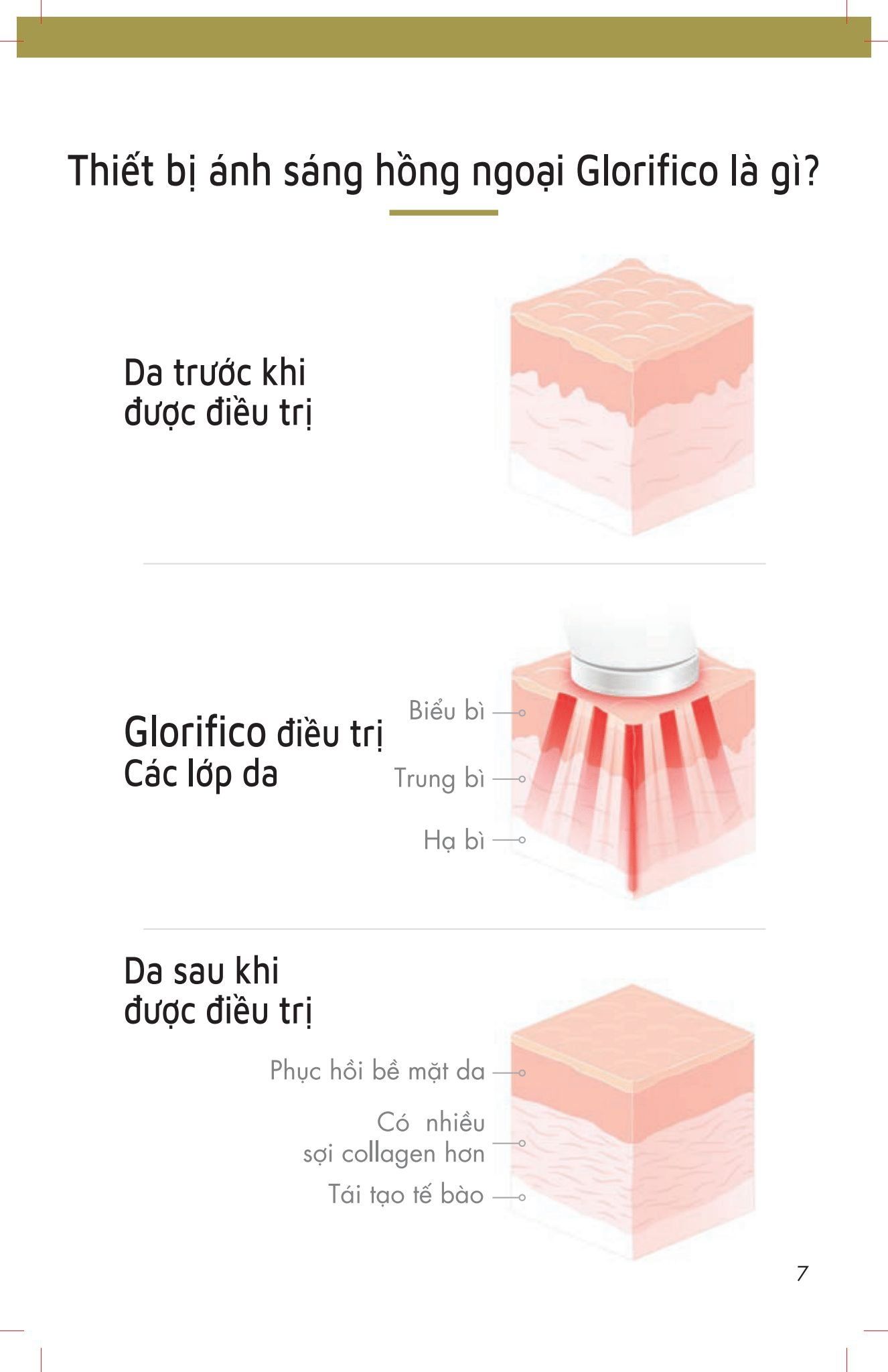 GLORIFICO