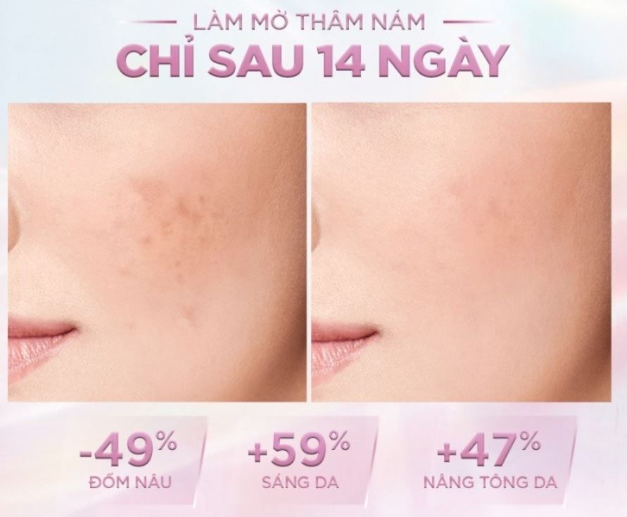 Sữa Rửa Mặt Sáng Da L'Oreal Paris Glycolic-Bright Glowing Daily Cleanser Foam 100ml